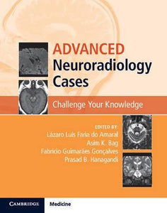 Advanced Neuroradiology Cases by Amaral, Lazaro Luis Faria do