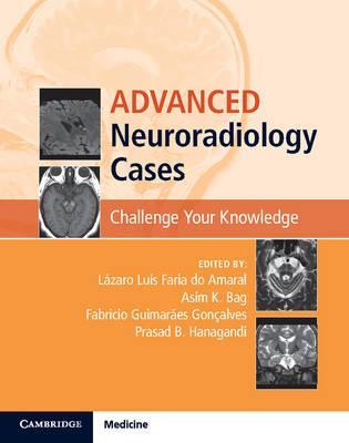 Advanced Neuroradiology Cases by Amaral, Lazaro Luis Faria do